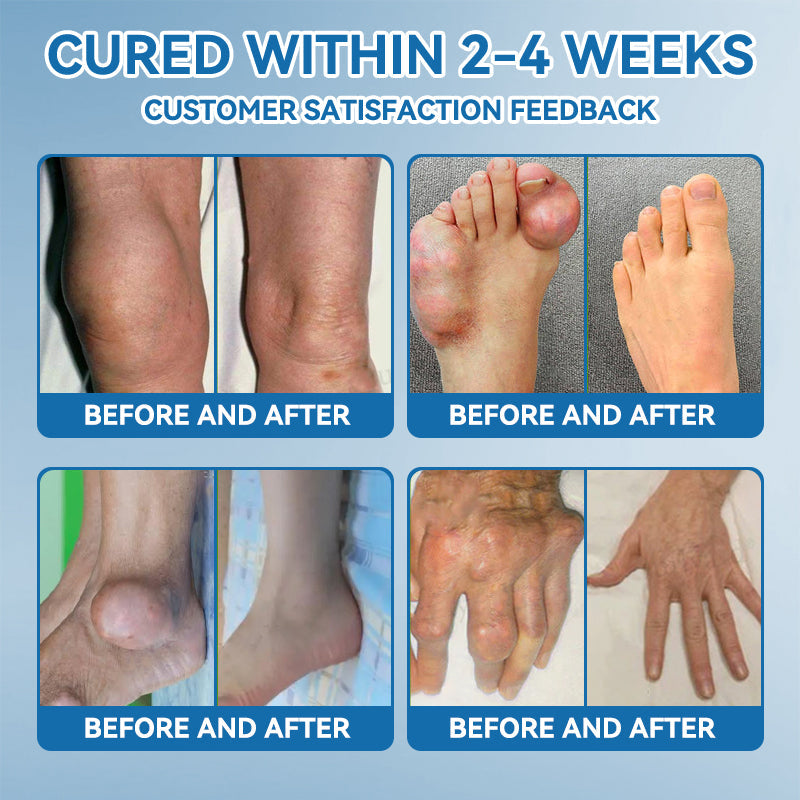 Don't miss out! Enjoy half price on all selected items for a limited time👩⚕️𝖯𝗂𝖼𝗱𝗼® BPC-157 Joint Healing Cream - 30% Off - Today Only!