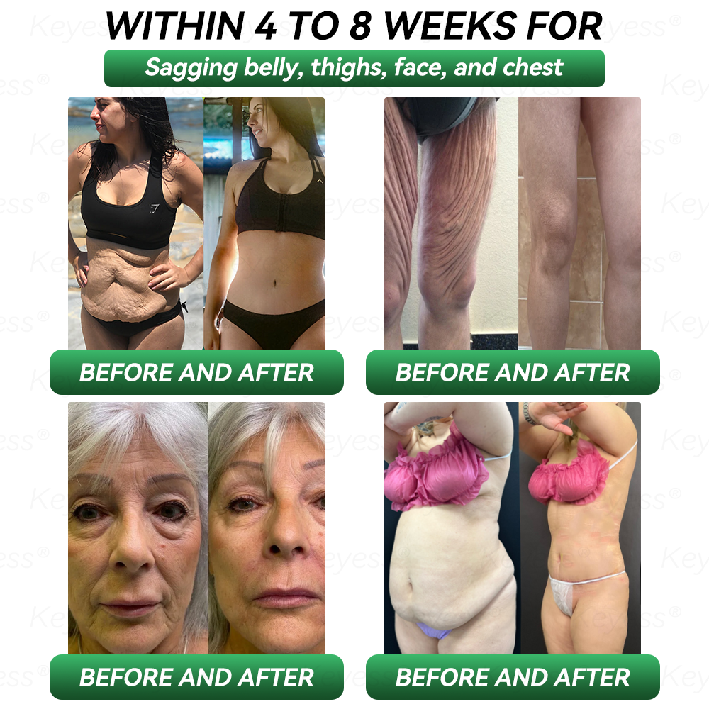 Official Store| ๐๐๐ฒ๐๐๐ยฎ GLP-1 & MatrixyI 3000 SIimming & HealIth Dropsโ
Just one dose a day โ visible results in just 7 days๐ฟFor obesity, cardiovascular health, diabetes, sleep apnea, joint issues, and more๐