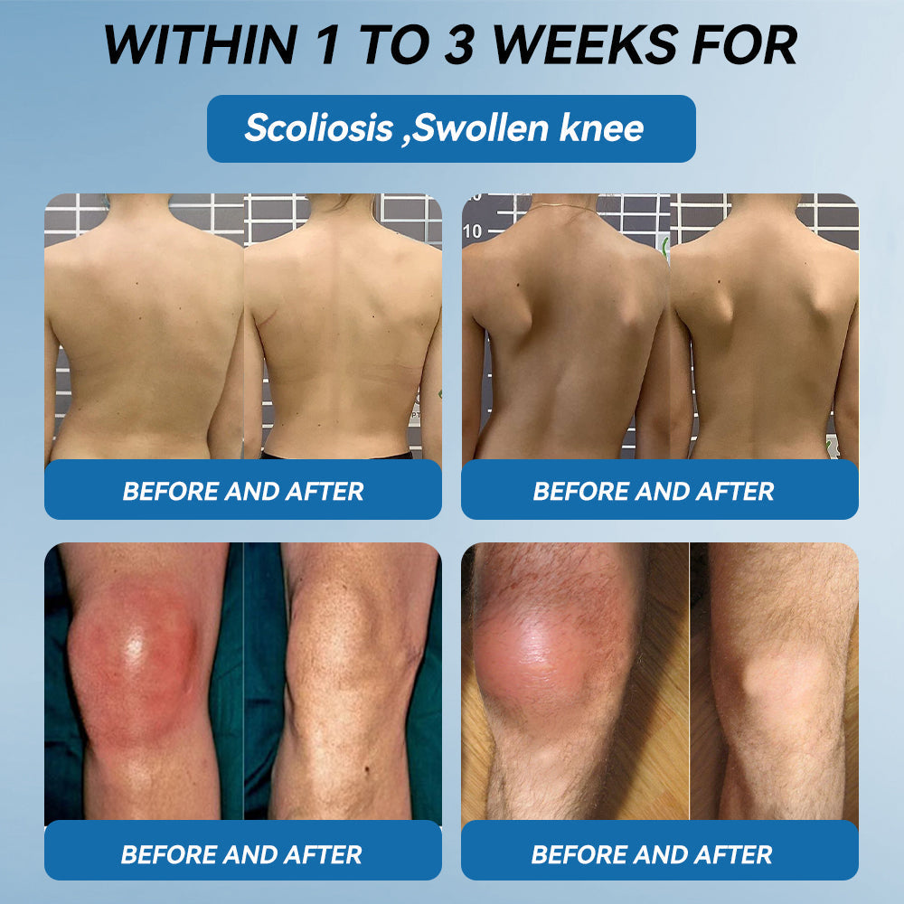 Don't miss out! Enjoy half price on all selected items for a limited time👩⚕️𝖯𝗂𝖼𝗱𝗼® BPC-157 Joint Healing Cream - 30% Off - Today Only!