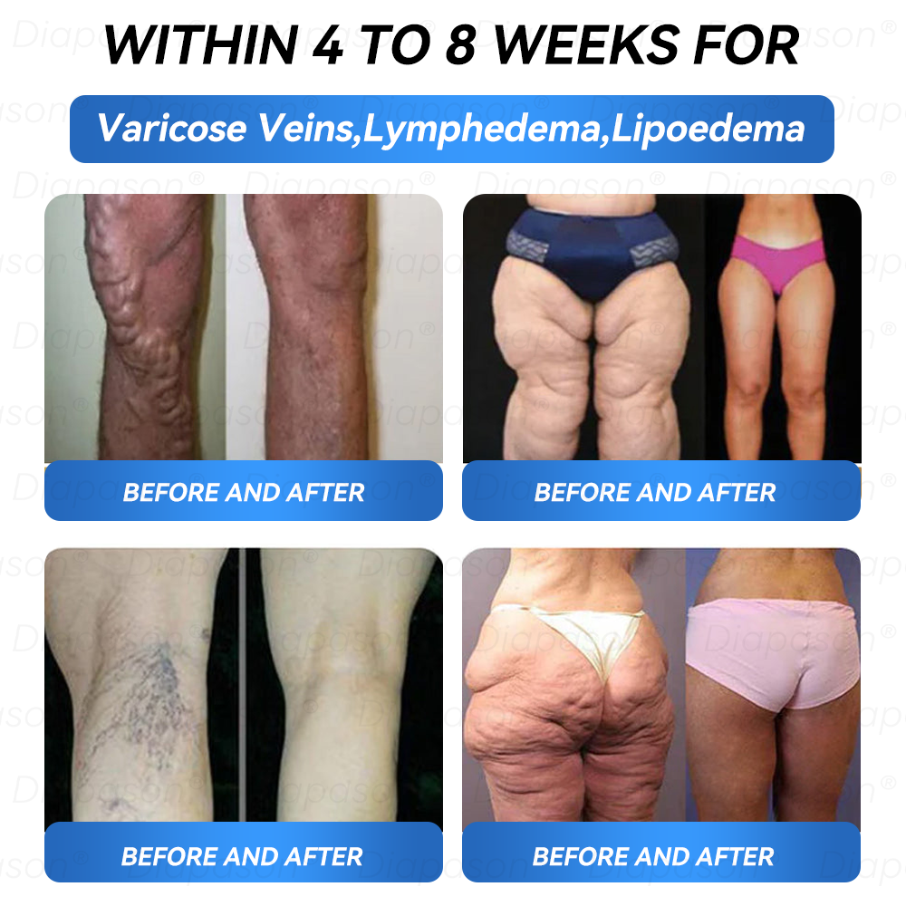 𝑶𝒇𝒇𝒊𝒄𝒊𝒂𝒍 𝑺𝒕𝒐𝒓𝒆 | 𝐷𝑖𝑎𝑝𝑎𝑠𝑜𝑛® GLP-1 9 IN 1 Health Solution Oral Liquid👩‍⚕️(One dose per day, noticeable changes within 7 days) 👍 Suitable for weight loss, cardiovascular health, diabetes, sleep apnea, joint problems, and many more health issues🎁