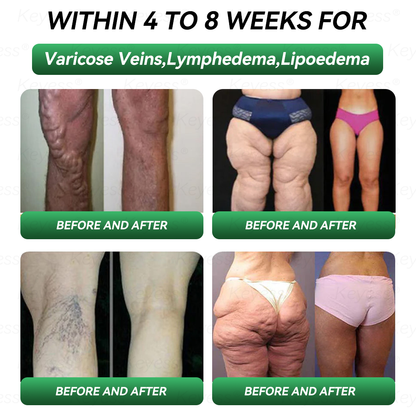 Official Store| 𝐊𝒆𝐲𝐞𝘀𝘀® GLP-1 & MatrixyI 3000 SIimming & HealIth Drops✅Just one dose a day — visible results in just 7 days🌿For obesity, cardiovascular health, diabetes, sleep apnea, joint issues, and more🍒