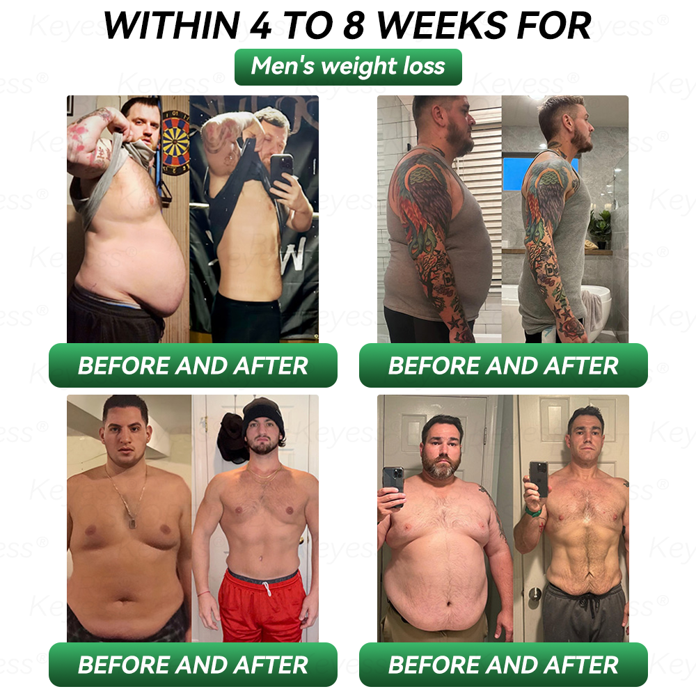 Official Store| 𝐊𝒆𝐲𝐞𝘀𝘀® GLP-1 & MatrixyI 3000 SIimming & HealIth Drops✅Just one dose a day — visible results in just 7 days🌿For obesity, cardiovascular health, diabetes, sleep apnea, joint issues, and more🍒