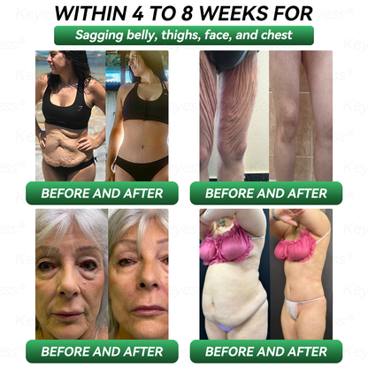 Official Store| 𝐊𝒆𝐲𝐞𝘀𝘀® GLP-1 & MatrixyI 3000 SIimming & HealIth Drops✅Just one dose a day — visible results in just 7 days🌿For obesity, cardiovascular health, diabetes, sleep apnea, joint issues, and more🍒