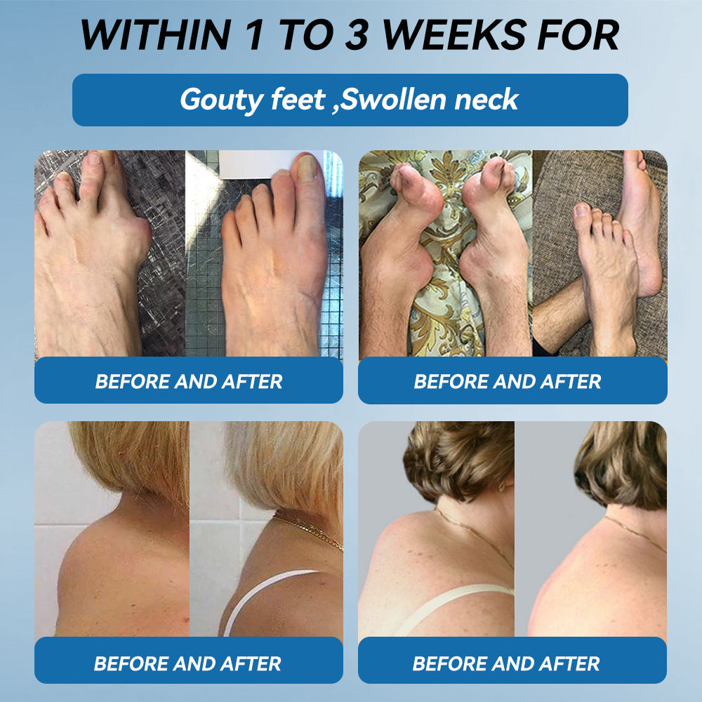 Don't miss out! Enjoy half price on all selected items for a limited time👩‍⚕️𝖯𝗂𝖼𝗱𝗼® BPC-157 Joint Healing Cream - 30% Off - Today Only!