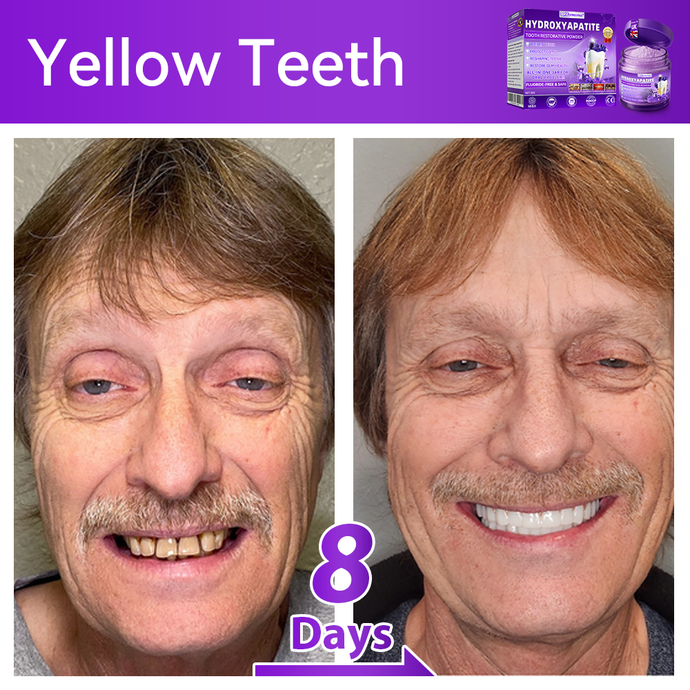 𝑫𝑜𝑟𝒎𝒐𝒓𝙣𝙖® 𝐻𝑦𝑑𝑟𝑜𝑥𝑦𝑎𝑝𝑎𝑡𝑖𝑡𝑒 𝑇𝑜𝑜𝑡ℎ 𝑅𝑒𝑠𝑡𝑜𝑟𝑎𝑡𝑖𝑣𝑒 𝑃𝑜𝑤𝑑𝑒𝑟💎Treatment for dental caries, periodontal disease, tooth sensitivity, and oral cancer 🦷