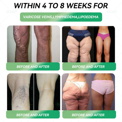 𝑶𝒇𝒇𝒊𝒄𝒊𝒂𝒍 𝑺𝒕𝒐𝒓𝒆 |𝐒𝐓𝐃𝐄𝐈® 𝐆𝐋𝐏-𝟏 Weight Loss Oral Solution✅𝐉𝐮𝐬𝐭 𝐨𝐧𝐜𝐞 𝐚 𝐝𝐚𝐲, 𝐯𝐢𝐬𝐢𝐛𝐥𝐞 𝐜𝐡𝐚𝐧𝐠𝐞𝐬 𝐢𝐧 𝟕 𝐝𝐚𝐲𝐬🍎