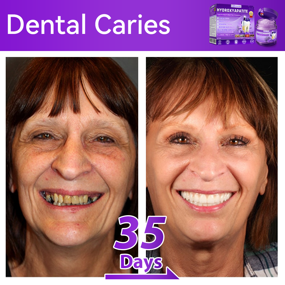 𝑫𝑜𝑟𝒎𝒐𝒓𝙣𝙖® 𝐻𝑦𝑑𝑟𝑜𝑥𝑦𝑎𝑝𝑎𝑡𝑖𝑡𝑒 𝑇𝑜𝑜𝑡ℎ 𝑅𝑒𝑠𝑡𝑜𝑟𝑎𝑡𝑖𝑣𝑒 𝑃𝑜𝑤𝑑𝑒𝑟💎Treatment for dental caries, periodontal disease, tooth sensitivity, and oral cancer 🦷