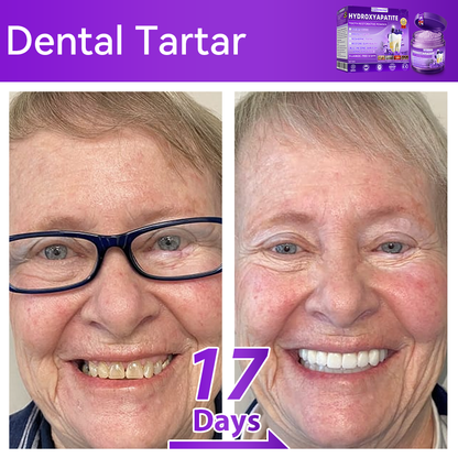 𝑫𝑜𝑟𝒎𝒐𝒓𝙣𝙖® 𝐻𝑦𝑑𝑟𝑜𝑥𝑦𝑎𝑝𝑎𝑡𝑖𝑡𝑒 𝑇𝑜𝑜𝑡ℎ 𝑅𝑒𝑠𝑡𝑜𝑟𝑎𝑡𝑖𝑣𝑒 𝑃𝑜𝑤𝑑𝑒𝑟💎Treatment for dental caries, periodontal disease, tooth sensitivity, and oral cancer 🦷