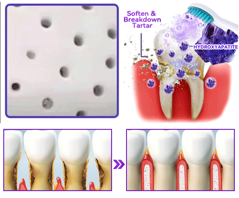 𝑫𝑜𝑟𝒎𝒐𝒓𝙣𝙖® 𝐻𝑦𝑑𝑟𝑜𝑥𝑦𝑎𝑝𝑎𝑡𝑖𝑡𝑒 𝑇𝑜𝑜𝑡ℎ 𝑅𝑒𝑠𝑡𝑜𝑟𝑎𝑡𝑖𝑣𝑒 𝑃𝑜𝑤𝑑𝑒𝑟💎Treatment for dental caries, periodontal disease, tooth sensitivity, and oral cancer 🦷